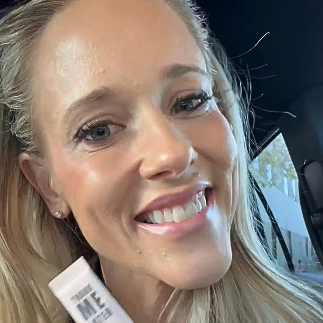 Microneedling | Skinpen®