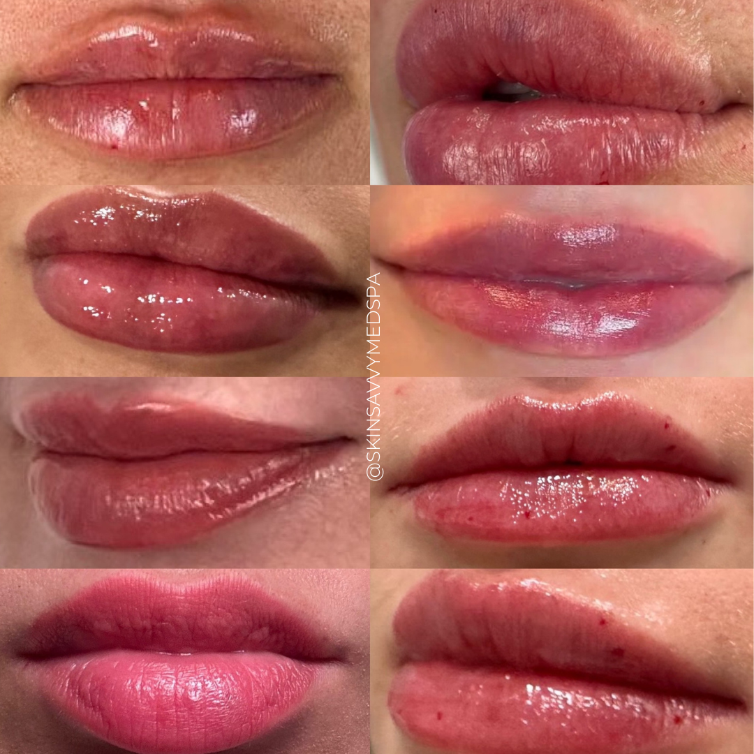 Signature Lip Treatment