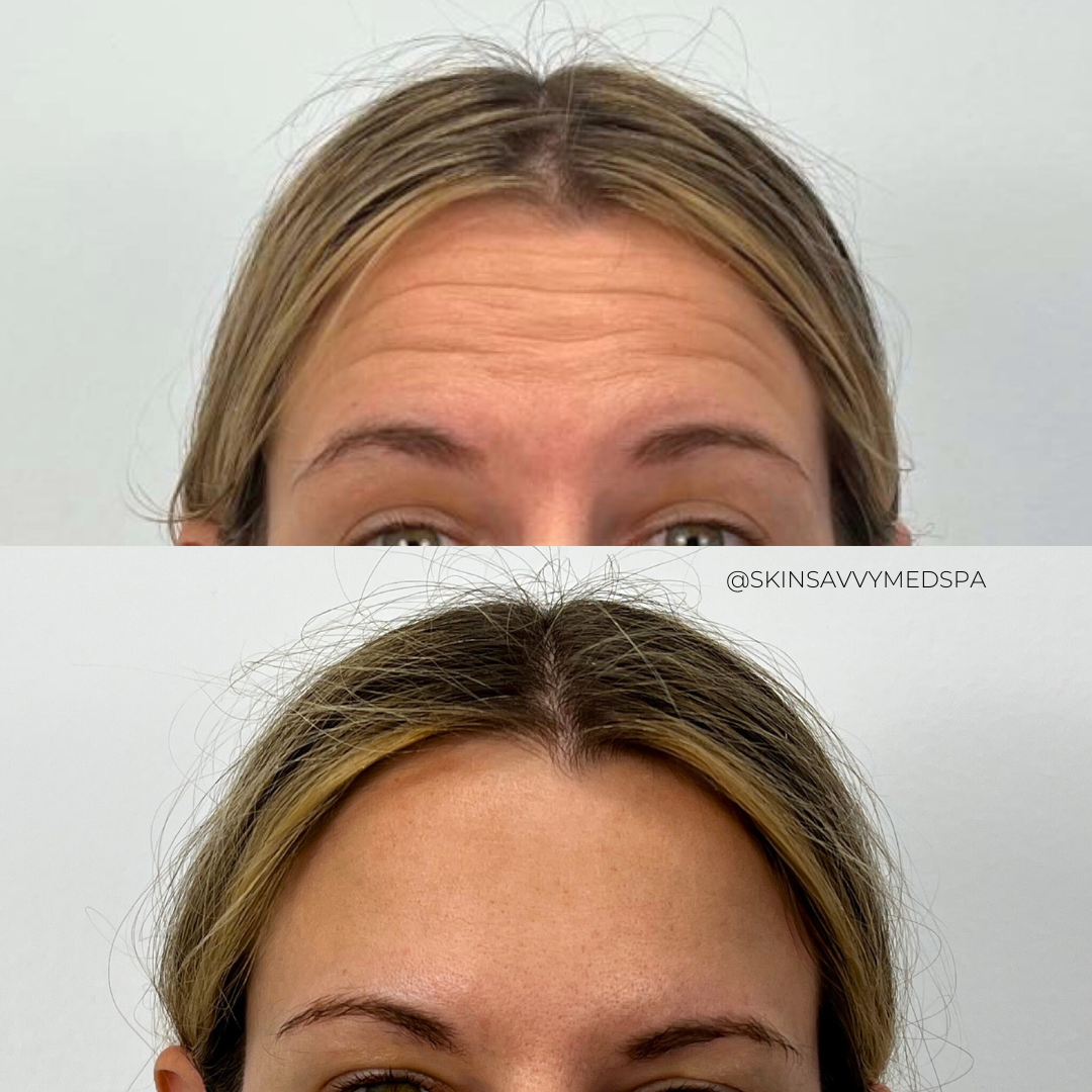 Savvy Tox | New Patient Offer