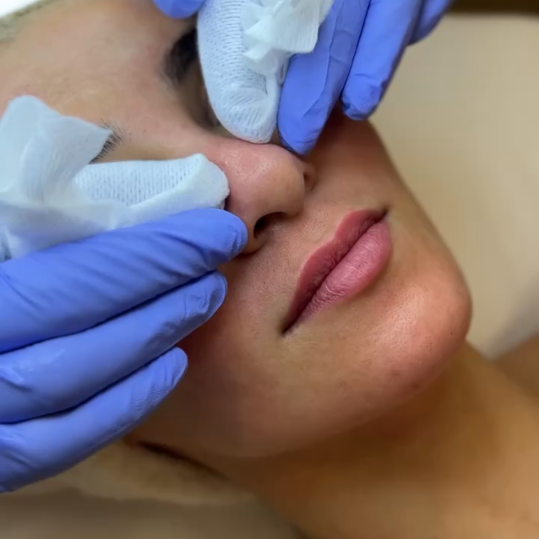 Facial | Custom | New Patient Promo