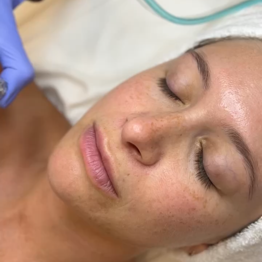 Facial | Diamond Glow | New Patient Promo