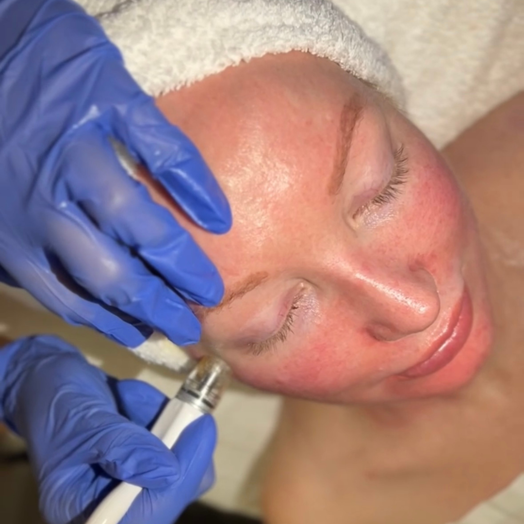 Facials | 1st Time Patient Promo