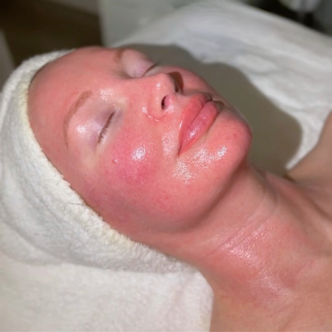 Facials | 1st Time Patient Promo