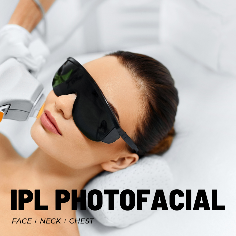 IPL PHOTOFACIAL FACE + NECK + CHEST PACKAGE