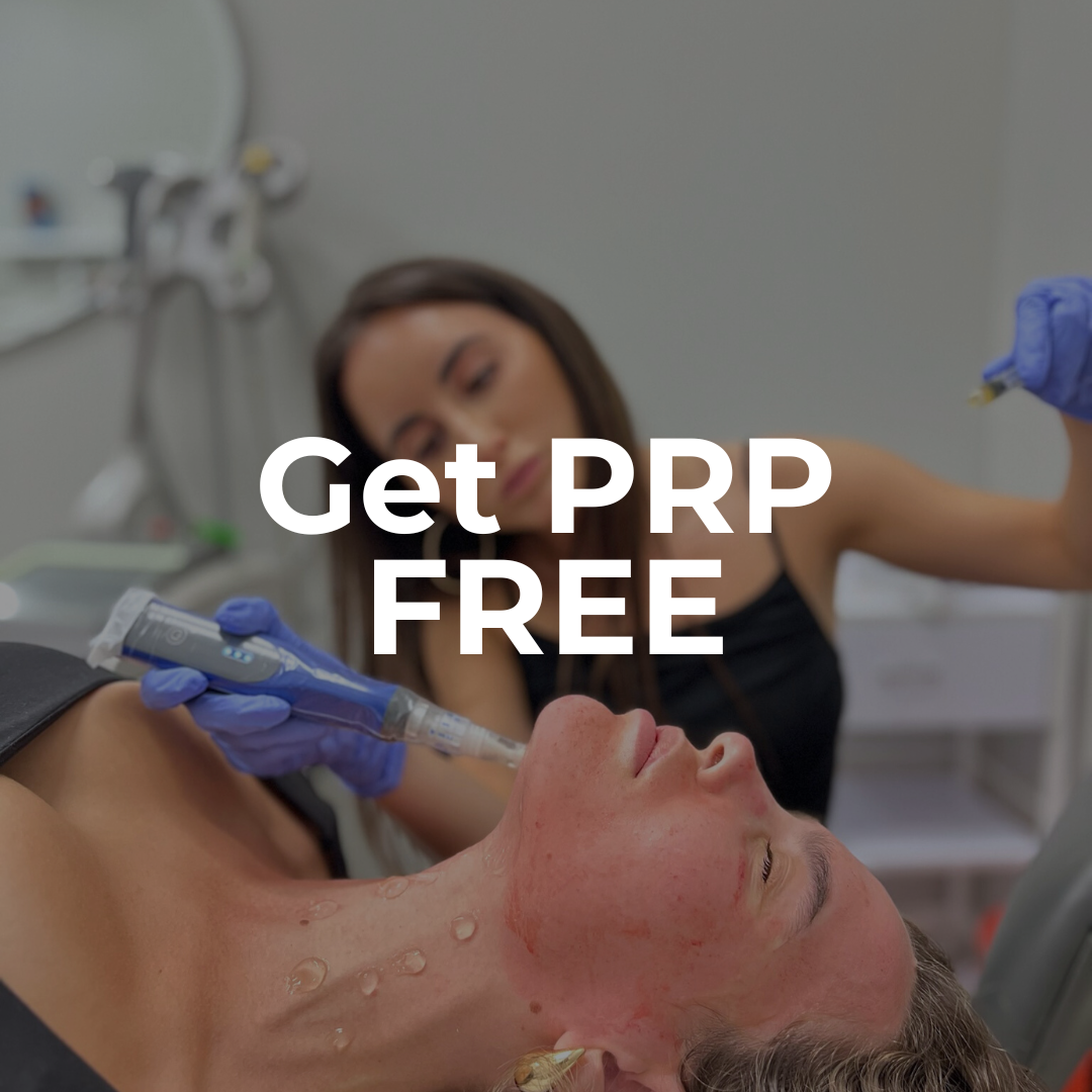 Black Friday | Microneedling With PRP