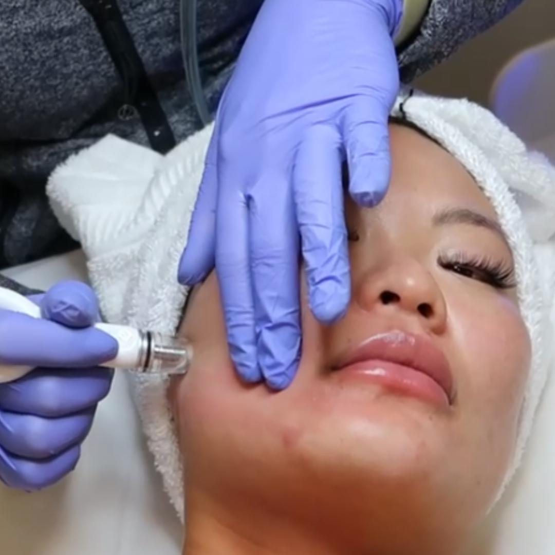 Facial | Diamond Glow | New Patient Promo