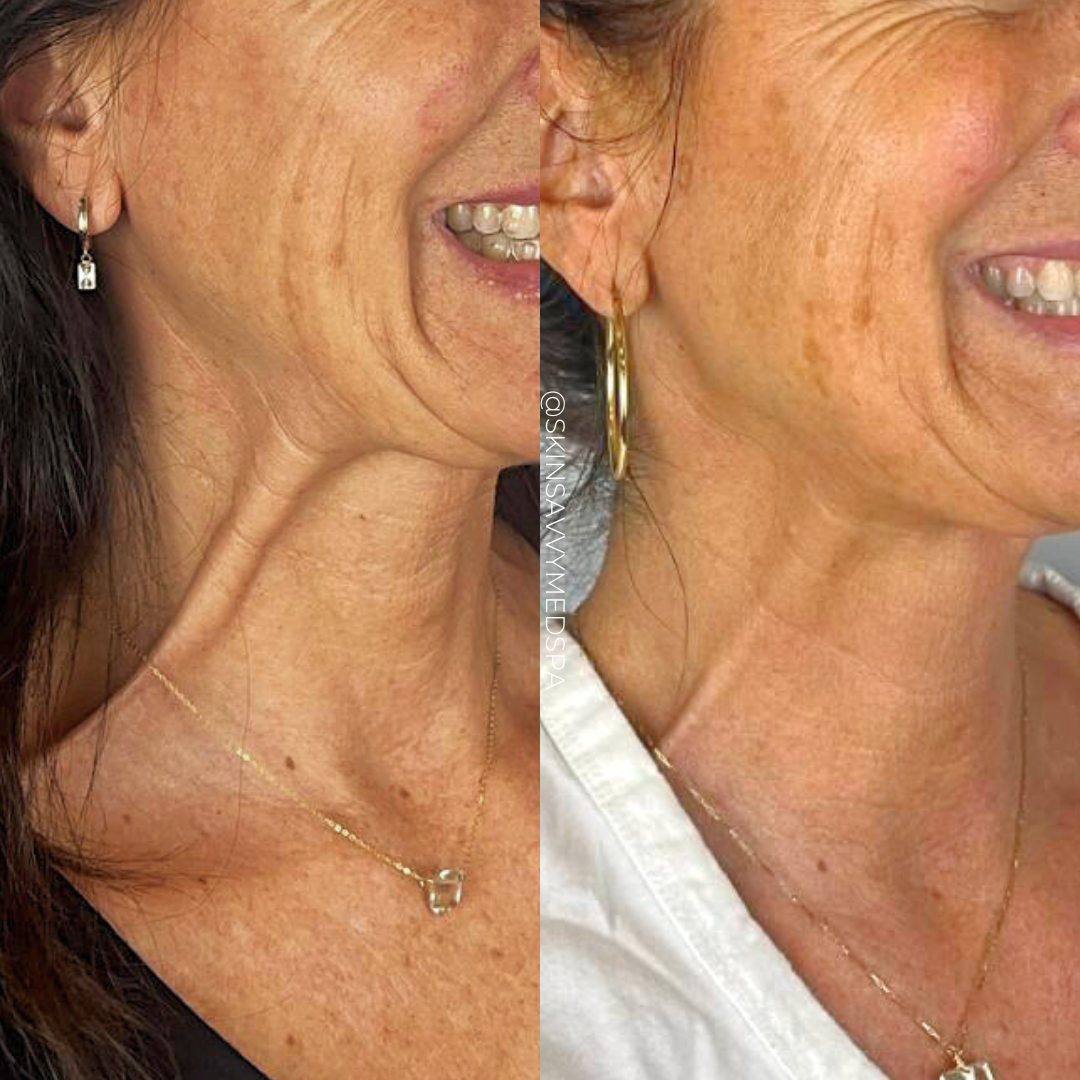 Savvy Tox | New Patient Offer