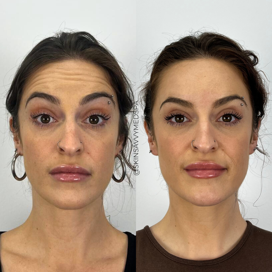 Savvy Tox | New Patient Offer