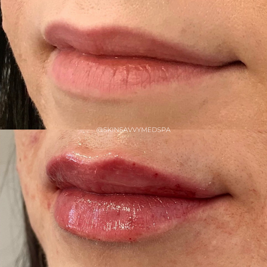 Signature Lip Treatment