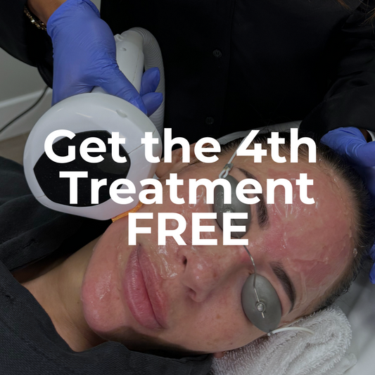 Black Friday | IPL Photofacial