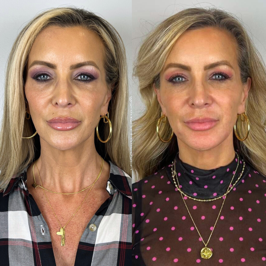 Rebuild Skin Naturally | Special Offer