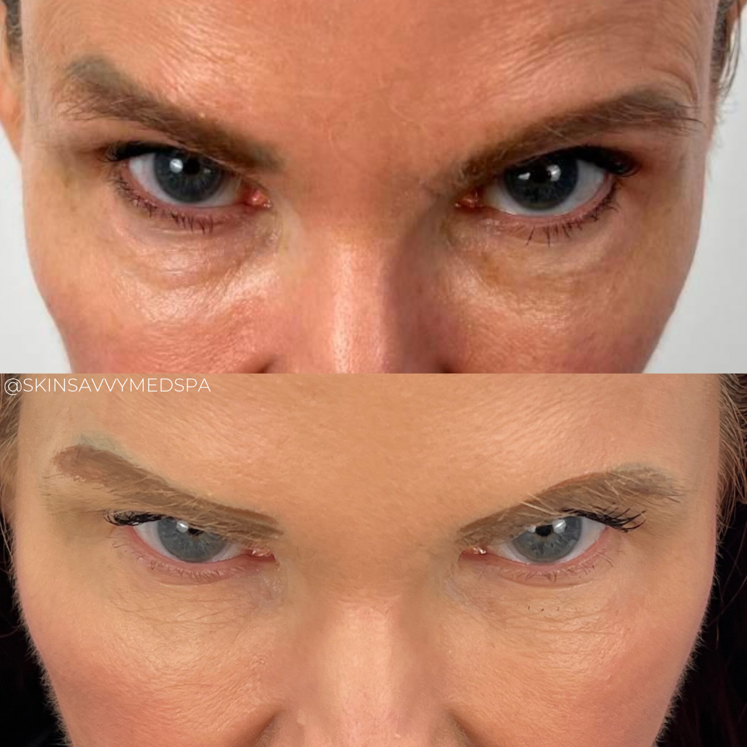 Under Eye Treatment | Special Offer