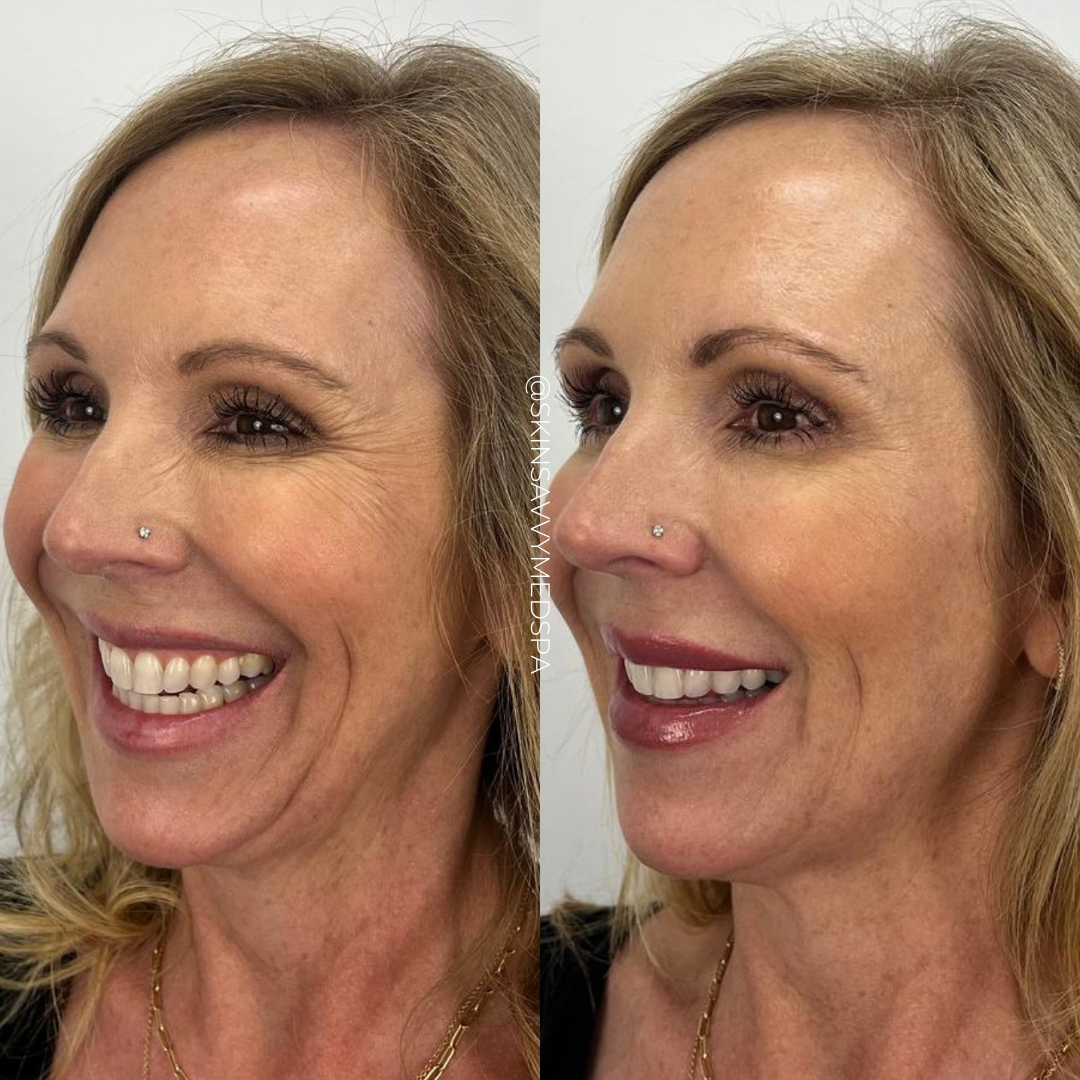 Savvy Tox | New Patient Offer