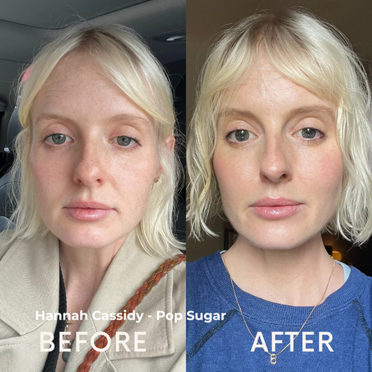 Rebuild Skin Naturally | Special Offer