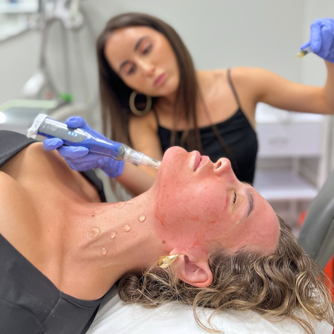 PRP Microneedling | New Patient Promo