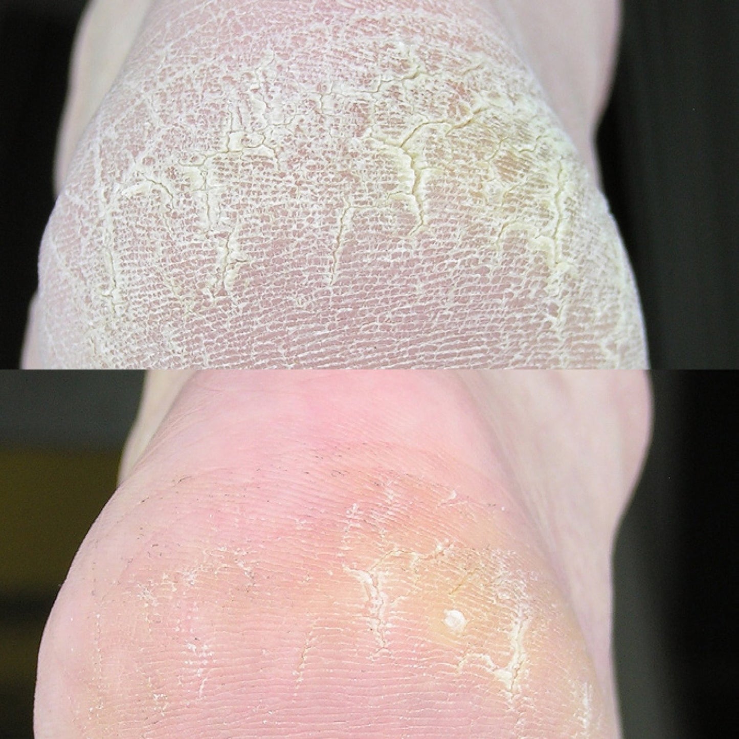 SKIN SAVVY MD FOOT FETISH